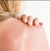 6 Natural Remedies on How to Treat Sunburned Skin