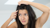 Natural Treatments for Dealing With Dandruff