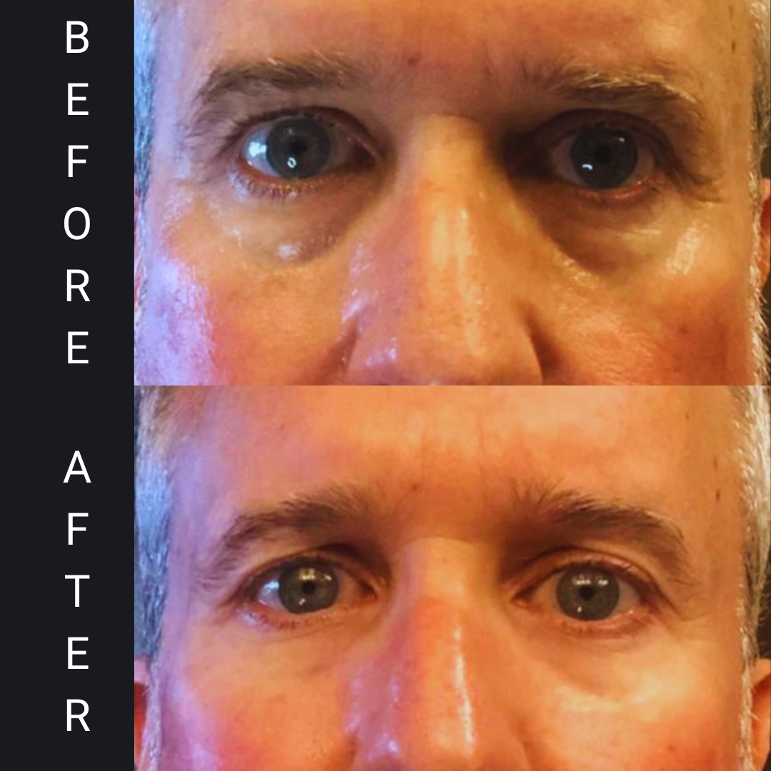 MAX REVITAL-EYES Natural Rapid Firming Eye Serum