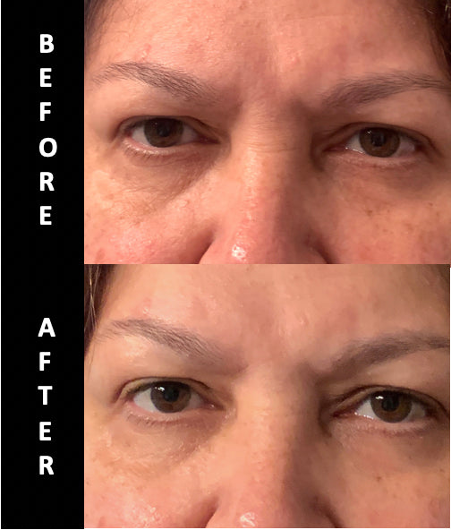 MAX REVITAL-EYES Natural Rapid Firming Eye Serum