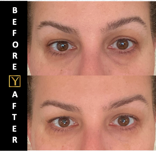 MAX REVITAL-EYES Natural Rapid Firming Eye Serum