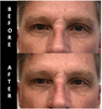 MAX REVITAL-EYES Natural Rapid Firming Eye Serum