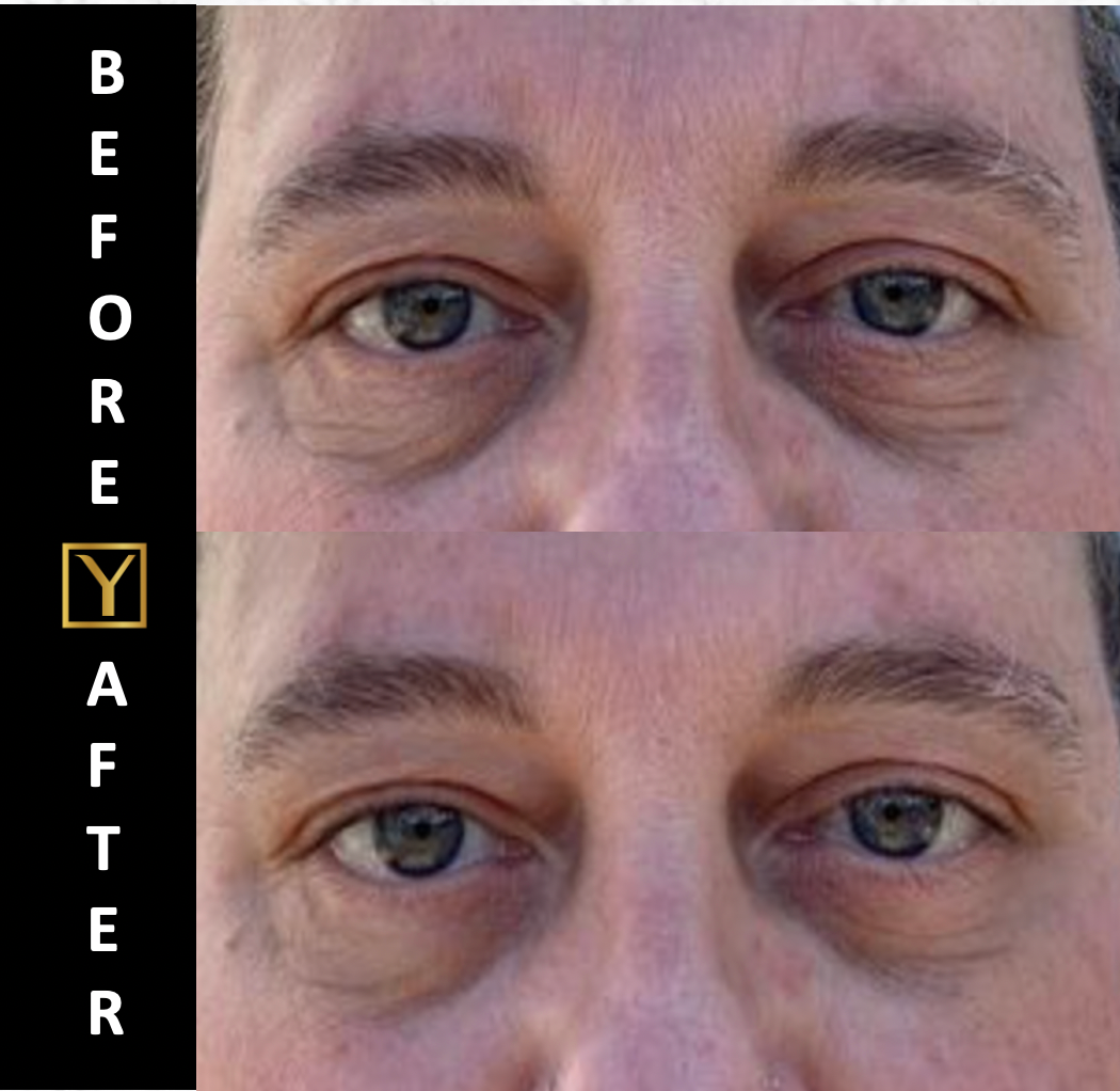 MAX REVITAL-EYES Natural Rapid Firming Eye Serum